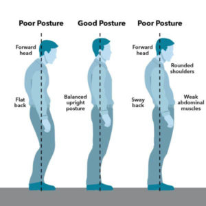 Why are posture and positioning important for hypermobility?